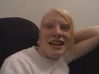Albino is suger og fucks