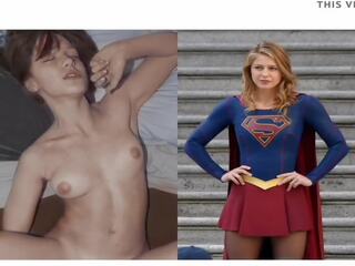 Melissa Benoist Supergirl, Free flirty Nudists HD sex be